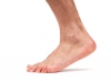 Fixing Flat Feet