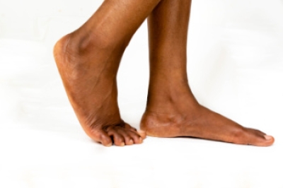 Treating Pain Caused by Flat Feet