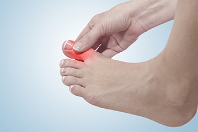 Managing Gout